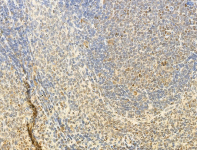 Phospho-FOXO3A (Ser253) Antibody in Immunohistochemistry (Paraffin) (IHC (P))