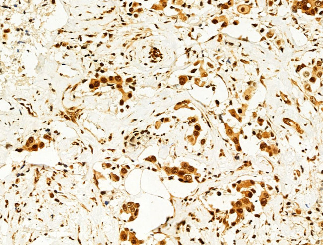 Phospho-FOXO3A (Ser253) Antibody in Immunohistochemistry (Paraffin) (IHC (P))