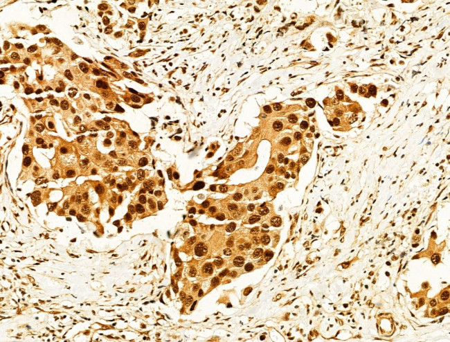 Phospho-FOXO3A (Ser253) Antibody in Immunohistochemistry (Paraffin) (IHC (P))