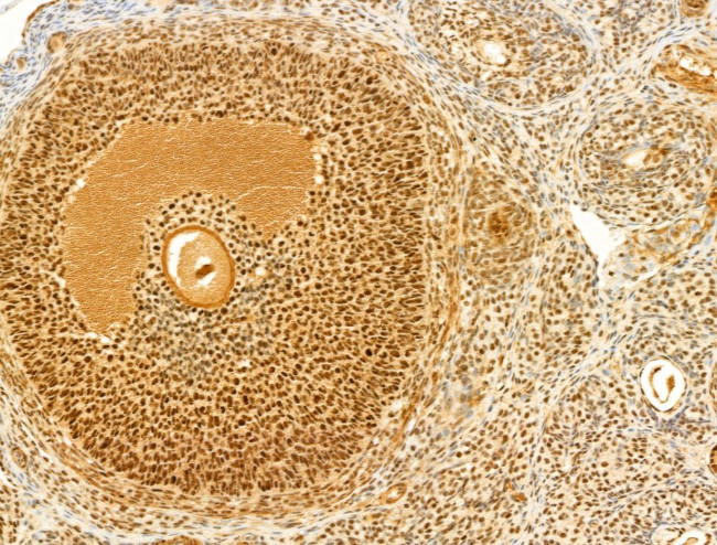 Phospho-FOXO3A (Ser253) Antibody in Immunohistochemistry (Paraffin) (IHC (P))