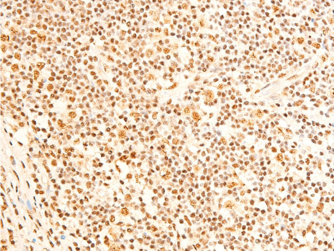 Phospho-FOXO3A (Ser253) Antibody in Immunohistochemistry (Paraffin) (IHC (P))