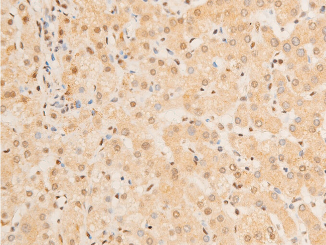 Phospho-FOXO3A (Ser253) Antibody in Immunohistochemistry (Paraffin) (IHC (P))