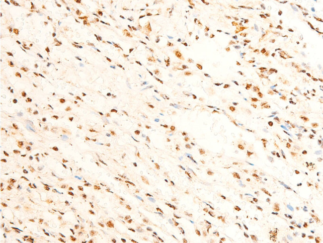 Phospho-FOXO3A (Ser253) Antibody in Immunohistochemistry (Paraffin) (IHC (P))