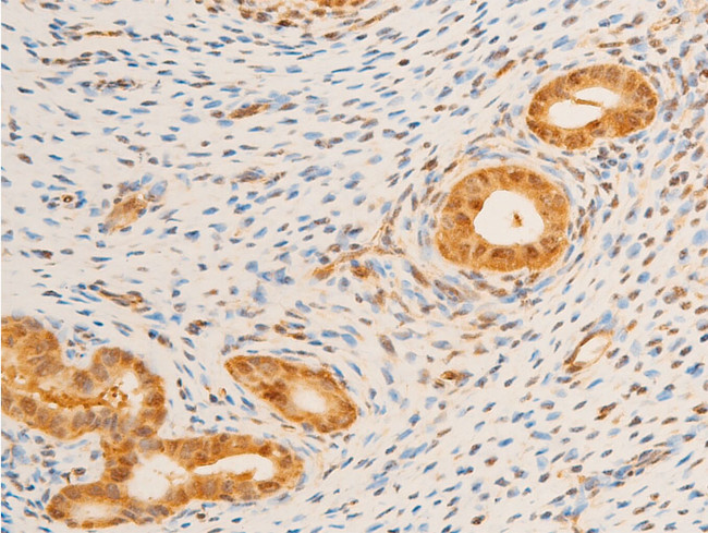 Phospho-FOXO3A (Ser253) Antibody in Immunohistochemistry (Paraffin) (IHC (P))