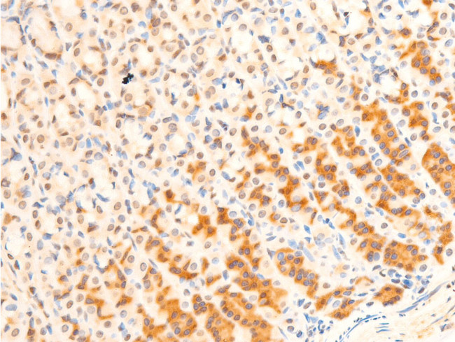 Phospho-FOXO3A (Ser253) Antibody in Immunohistochemistry (Paraffin) (IHC (P))