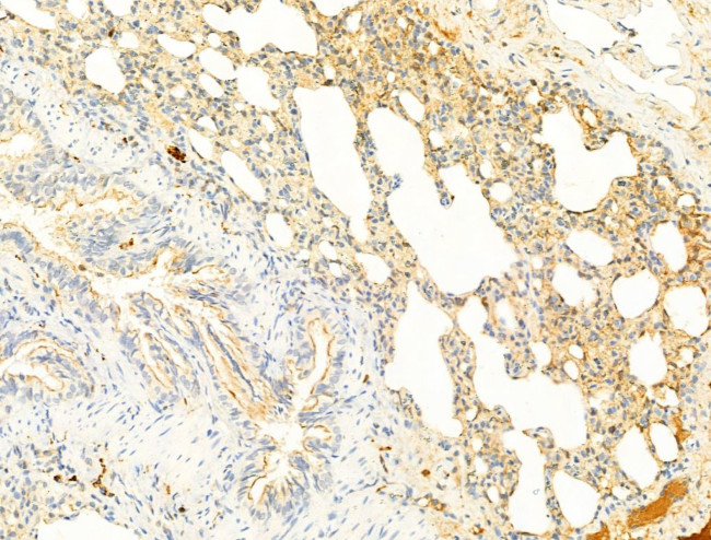 Phospho-ROCK2 (Tyr722) Antibody in Immunohistochemistry (Paraffin) (IHC (P))