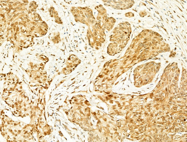 Phospho-JNK1/JNK2/JNK3 (Thr183, Tyr185) Antibody in Immunohistochemistry (Paraffin) (IHC (P))