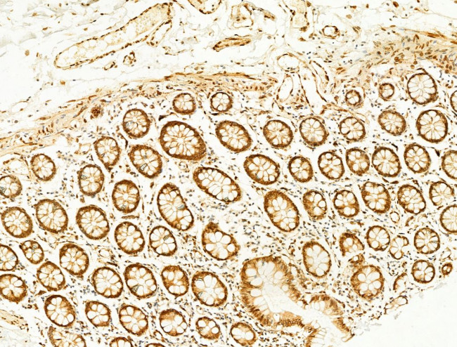 Phospho-JNK1/JNK2/JNK3 (Thr183, Tyr185) Antibody in Immunohistochemistry (Paraffin) (IHC (P))