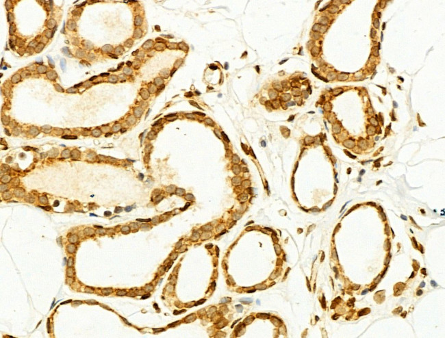 Phospho-JNK1/JNK2/JNK3 (Thr183, Tyr185) Antibody in Immunohistochemistry (Paraffin) (IHC (P))