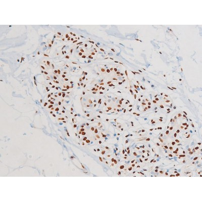 Phospho-JNK1/JNK2/JNK3 (Thr183, Tyr185) Antibody in Immunohistochemistry (Paraffin) (IHC (P))