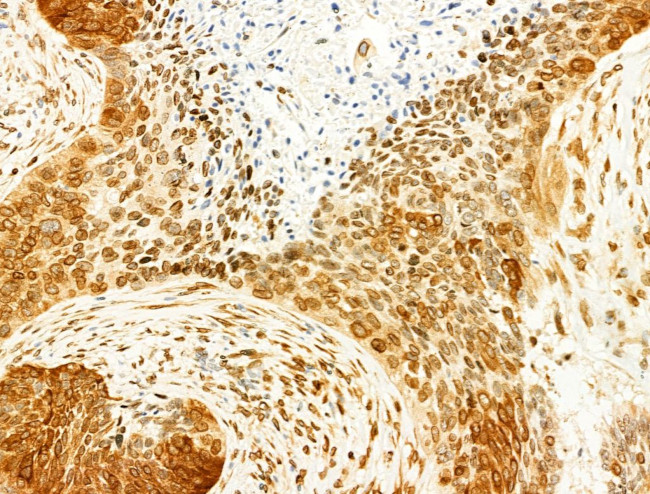 Phospho-JNK1/JNK2/JNK3 (Thr183, Tyr185) Antibody in Immunohistochemistry (Paraffin) (IHC (P))