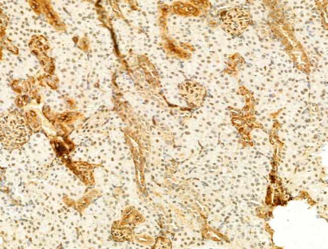 Phospho-JNK1/JNK2/JNK3 (Thr183, Tyr185) Antibody in Immunohistochemistry (Paraffin) (IHC (P))