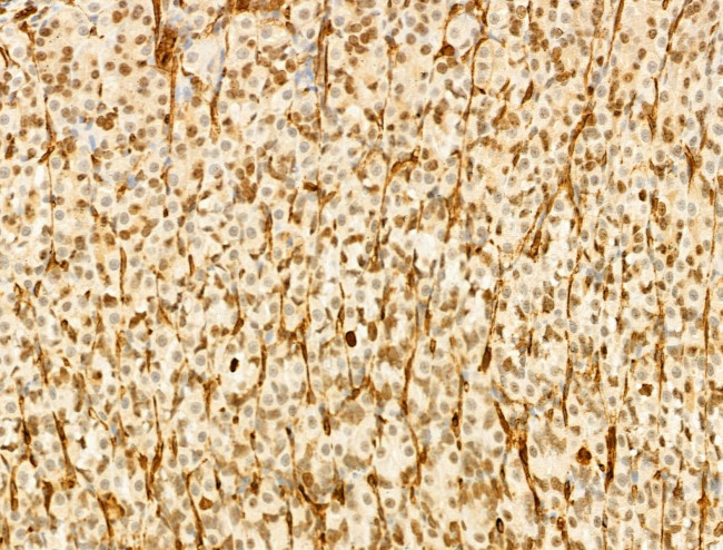 Phospho-JNK1/JNK2/JNK3 (Thr183, Tyr185) Antibody in Immunohistochemistry (Paraffin) (IHC (P))