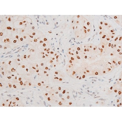 Phospho-JNK1/JNK2/JNK3 (Thr183, Tyr185) Antibody in Immunohistochemistry (Paraffin) (IHC (P))