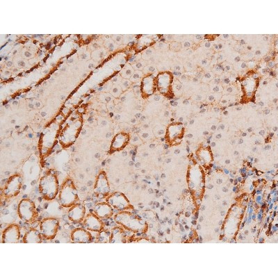 Phospho-JNK1/JNK2/JNK3 (Thr183, Tyr185) Antibody in Immunohistochemistry (Paraffin) (IHC (P))