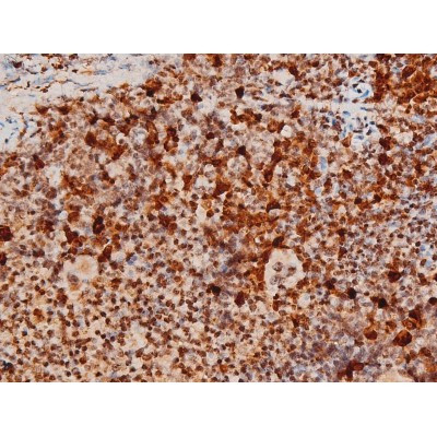 Phospho-JNK1/JNK2/JNK3 (Thr183, Tyr185) Antibody in Immunohistochemistry (Paraffin) (IHC (P))