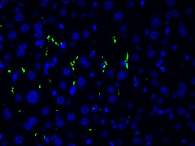 Phospho-LIMK1 (Thr508) Antibody in Immunocytochemistry (ICC/IF)