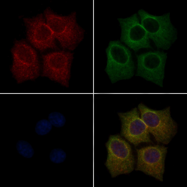 Phospho-LIMK1 (Thr508) Antibody in Immunocytochemistry (ICC/IF)