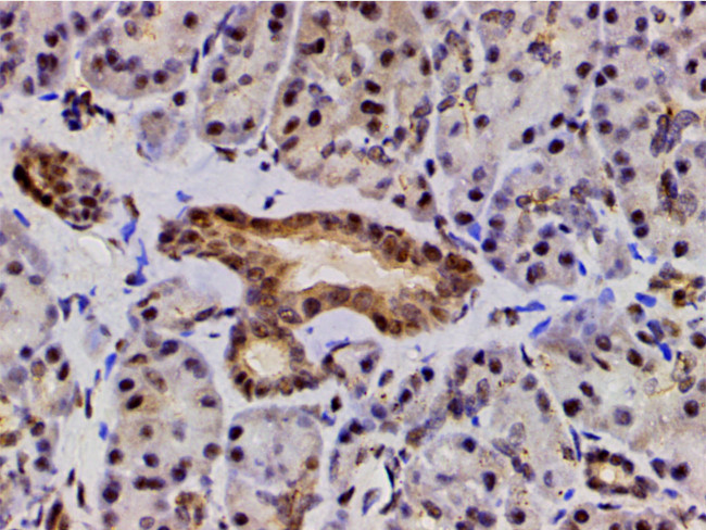 Phospho-LIMK1 (Thr508) Antibody in Immunohistochemistry (Paraffin) (IHC (P))