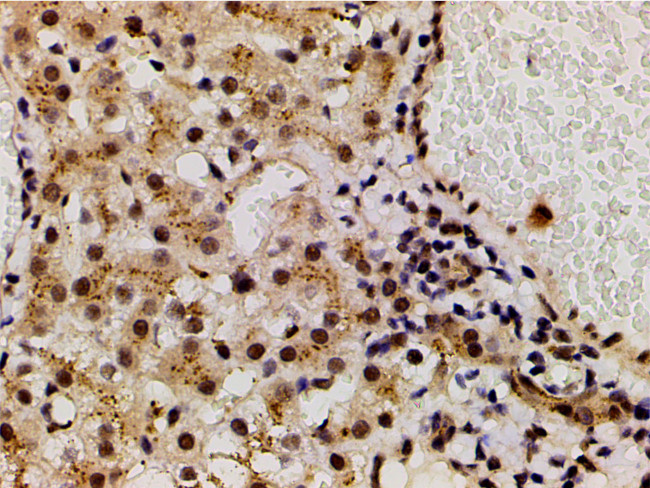 Phospho-LIMK1 (Thr508) Antibody in Immunohistochemistry (Paraffin) (IHC (P))