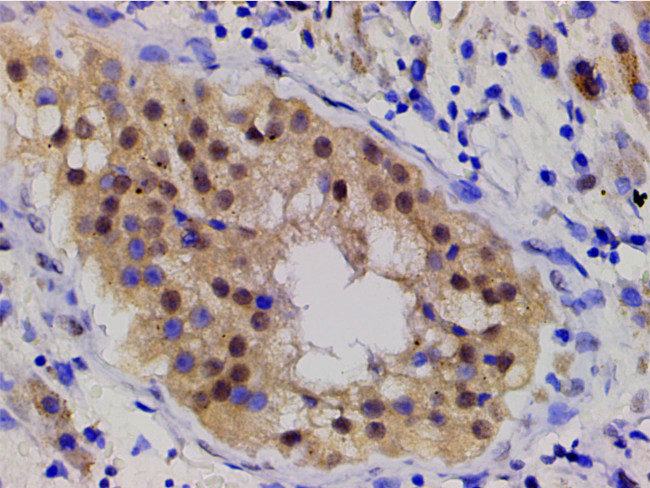 Phospho-LIMK1 (Thr508) Antibody in Immunohistochemistry (Paraffin) (IHC (P))