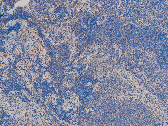 Phospho-LIMK1 (Thr508) Antibody in Immunohistochemistry (Paraffin) (IHC (P))