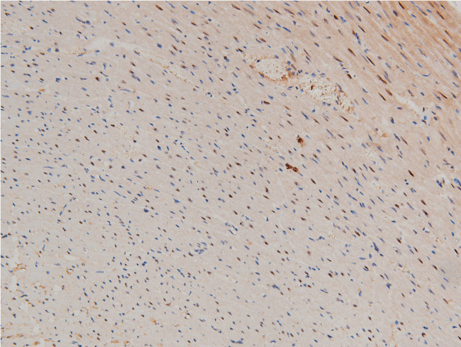 Phospho-LIMK1 (Thr508) Antibody in Immunohistochemistry (Paraffin) (IHC (P))