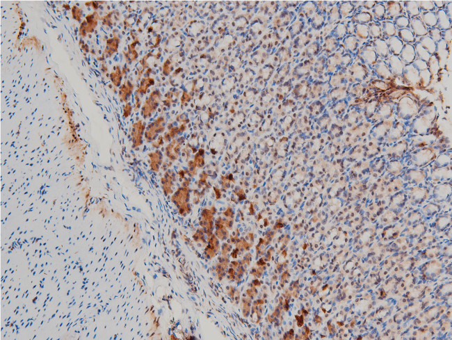 Phospho-LIMK1 (Thr508) Antibody in Immunohistochemistry (Paraffin) (IHC (P))