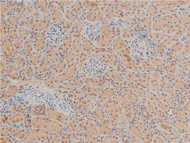 Phospho-LIMK1 (Thr508) Antibody in Immunohistochemistry (Paraffin) (IHC (P))