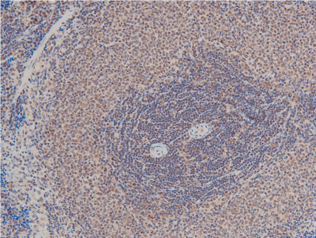 Phospho-LIMK1 (Thr508) Antibody in Immunohistochemistry (Paraffin) (IHC (P))