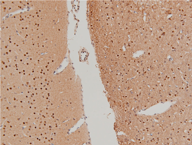 Phospho-LIMK1 (Thr508) Antibody in Immunohistochemistry (Paraffin) (IHC (P))