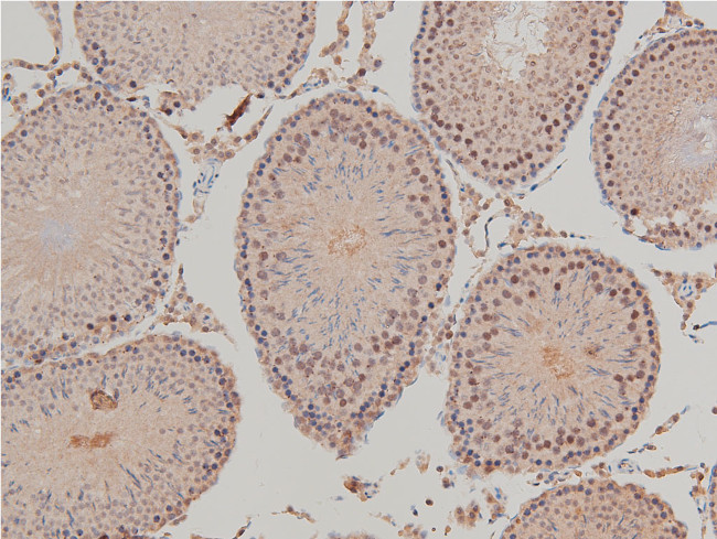 Phospho-LIMK1 (Thr508) Antibody in Immunohistochemistry (Paraffin) (IHC (P))