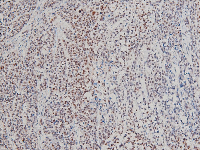 Phospho-LIMK1 (Thr508) Antibody in Immunohistochemistry (Paraffin) (IHC (P))