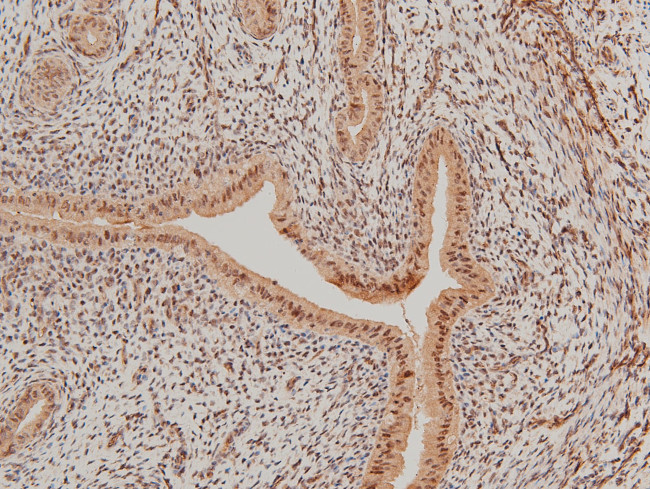 Phospho-LIMK1 (Thr508) Antibody in Immunohistochemistry (Paraffin) (IHC (P))