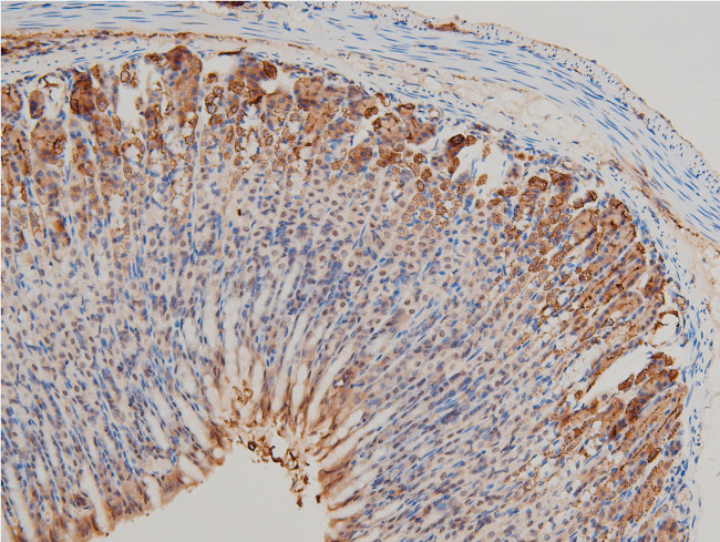 Phospho-LIMK1 (Thr508) Antibody in Immunohistochemistry (Paraffin) (IHC (P))