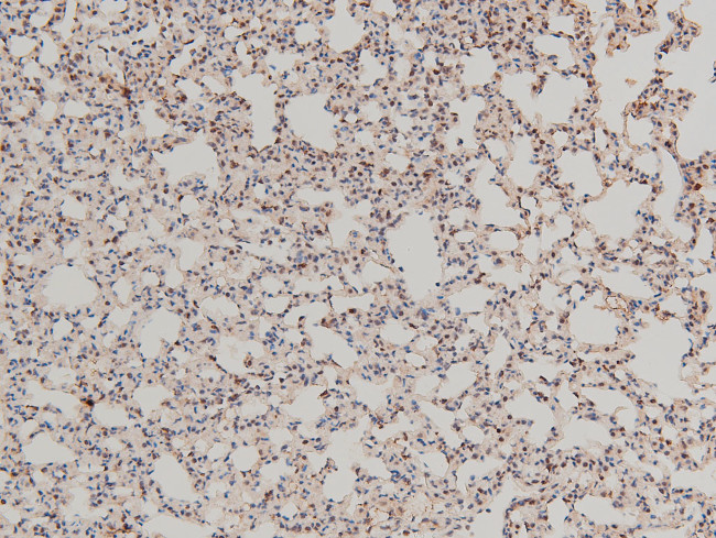 Phospho-LIMK1 (Thr508) Antibody in Immunohistochemistry (Paraffin) (IHC (P))