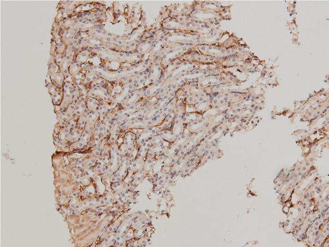 Phospho-LIMK1 (Thr508) Antibody in Immunohistochemistry (Paraffin) (IHC (P))