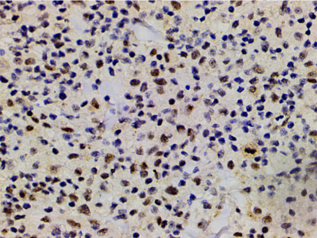 Phospho-LIMK1 (Thr508) Antibody in Immunohistochemistry (Paraffin) (IHC (P))