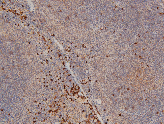 Phospho-LIMK1 (Thr508) Antibody in Immunohistochemistry (Paraffin) (IHC (P))