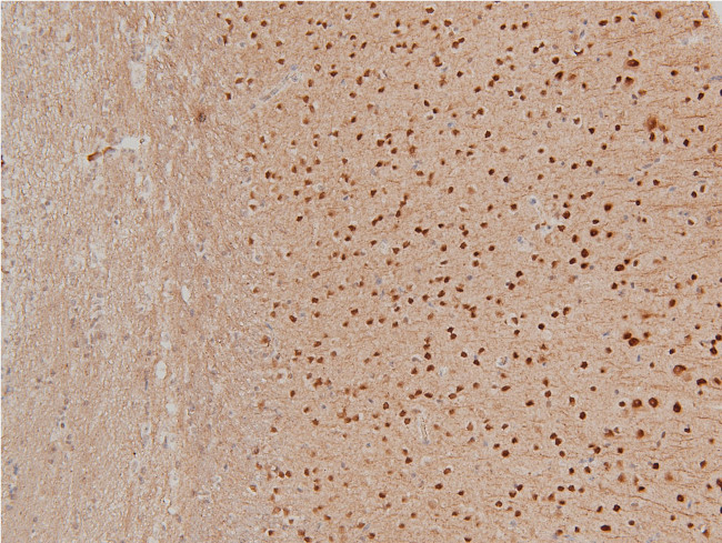 Phospho-LIMK1 (Thr508) Antibody in Immunohistochemistry (Paraffin) (IHC (P))