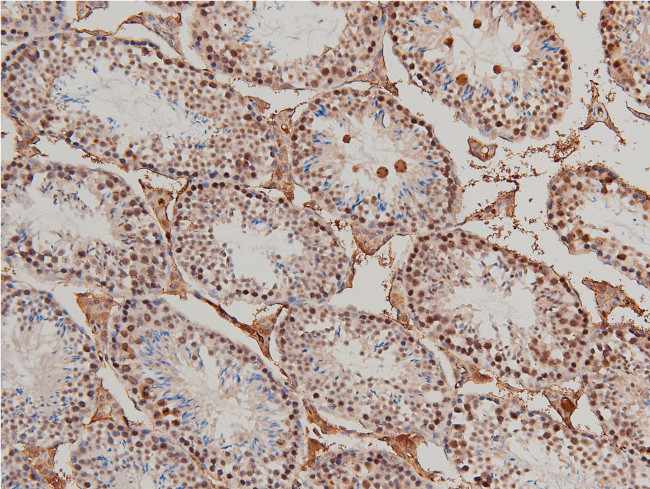 Phospho-LIMK1 (Thr508) Antibody in Immunohistochemistry (Paraffin) (IHC (P))