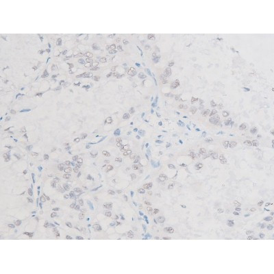 Phospho-LIMK1 (Thr508) Antibody in Immunohistochemistry (Paraffin) (IHC (P))