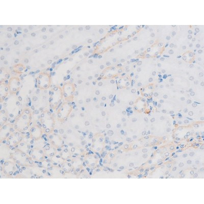 Phospho-LIMK1 (Thr508) Antibody in Immunohistochemistry (Paraffin) (IHC (P))