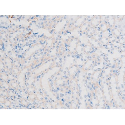 Phospho-LIMK1 (Thr508) Antibody in Immunohistochemistry (Paraffin) (IHC (P))