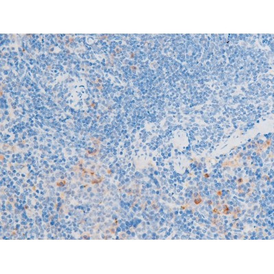 Phospho-LIMK1 (Thr508) Antibody in Immunohistochemistry (Paraffin) (IHC (P))