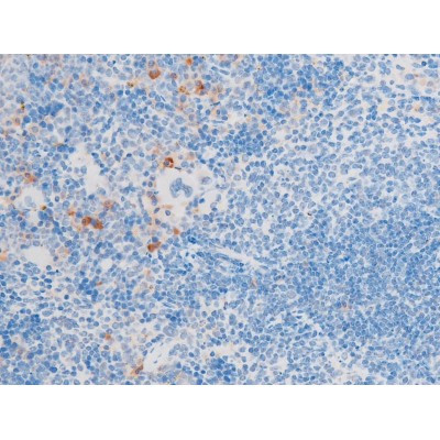 Phospho-LIMK1 (Thr508) Antibody in Immunohistochemistry (Paraffin) (IHC (P))