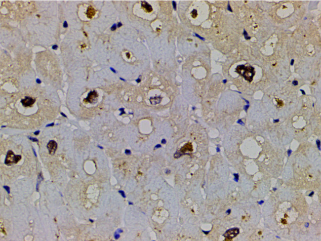 Phospho-LIMK1 (Thr508) Antibody in Immunohistochemistry (Paraffin) (IHC (P))