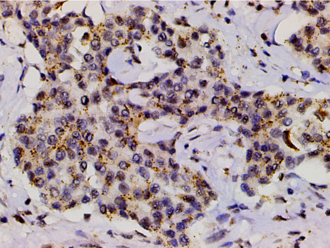 Phospho-LIMK1 (Thr508) Antibody in Immunohistochemistry (Paraffin) (IHC (P))