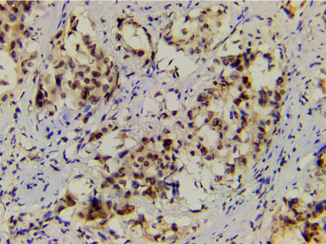 Phospho-LIMK1 (Thr508) Antibody in Immunohistochemistry (Paraffin) (IHC (P))