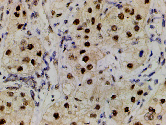 Phospho-LIMK1 (Thr508) Antibody in Immunohistochemistry (Paraffin) (IHC (P))